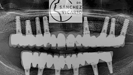 Gijón - CD SANCHEZ VICARIO - Centro Dental