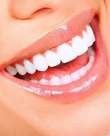 La Llagosta - CLINICA DENTAL DR. ERICK TARAZONA - Centro Dental