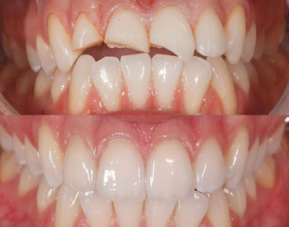 Murcia - CLINICA DENTAL DRA. MARIA JOSE CARRION DEL VALLE - Centro Dental
