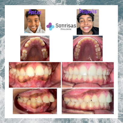 Gijón - CLINICA DENTAL MAS SONRISAS - Centro Dental