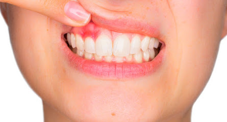 Torrevieja - CLINICA DENTAL S. FRANCISCO DE ASIS - Centro Dental