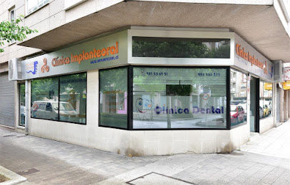 Ames - CLINICA IMPLANTE ORAL - Centro Dental